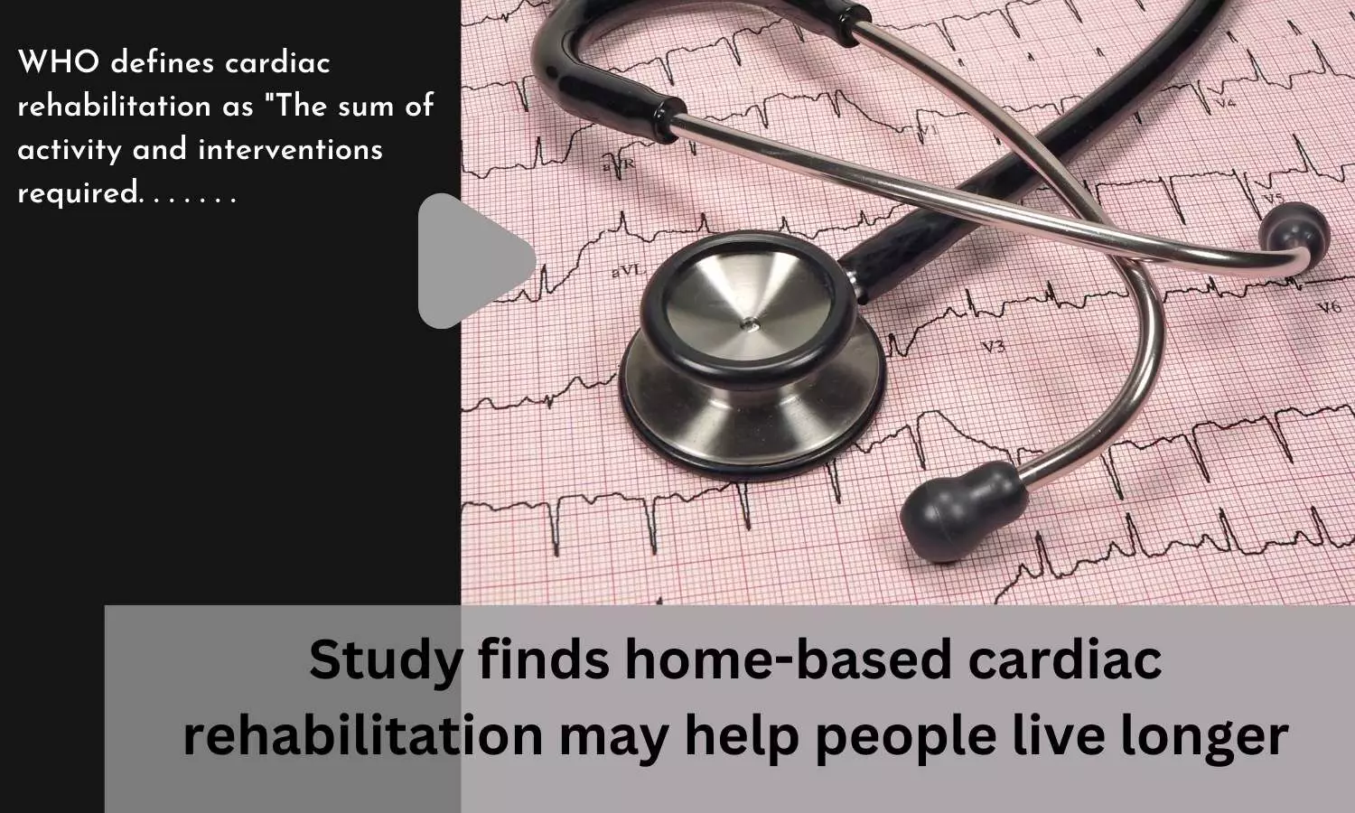 Study finds home-based cardiac rehabilitation may help people live longer