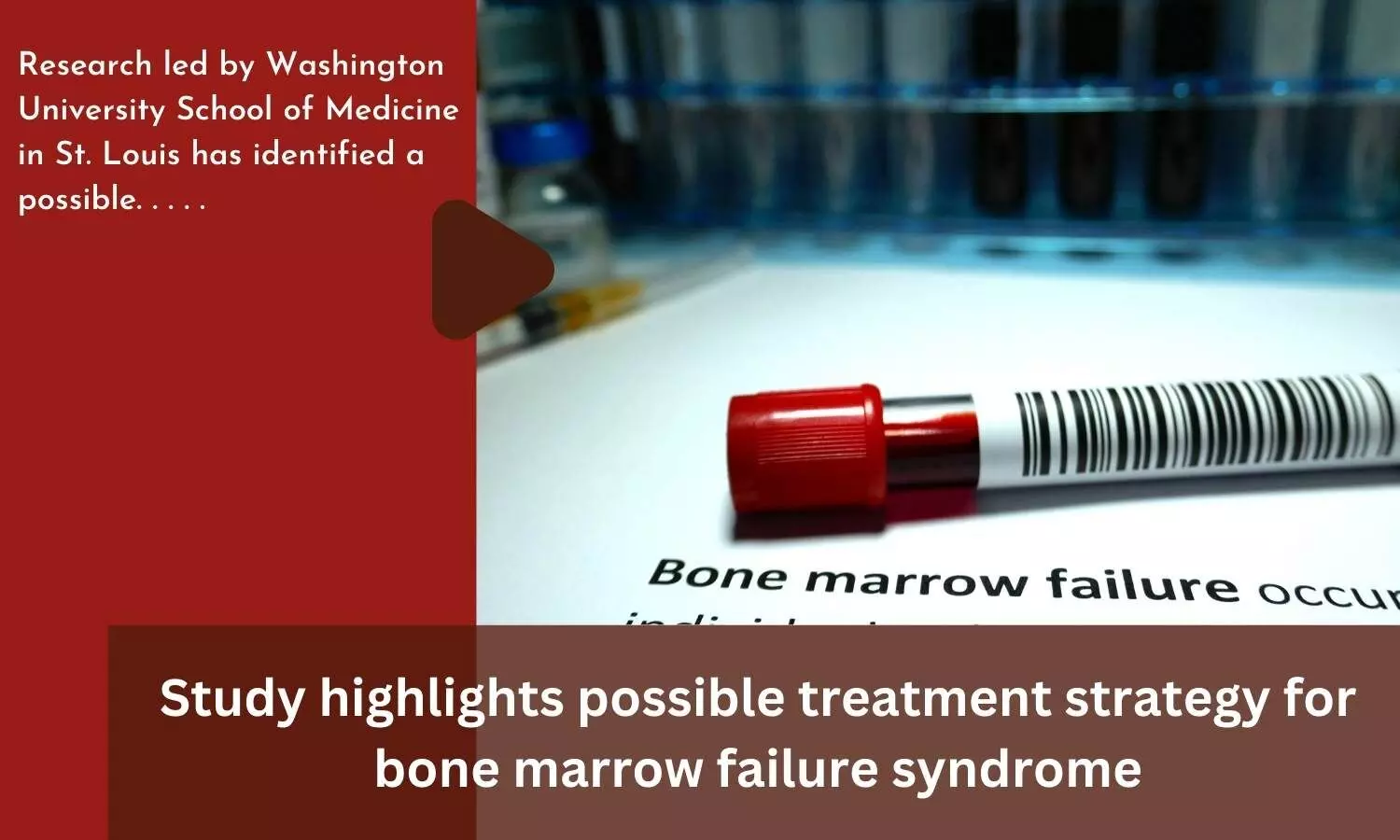 Study highlights possible treatment strategy for bone marrow failure syndrome