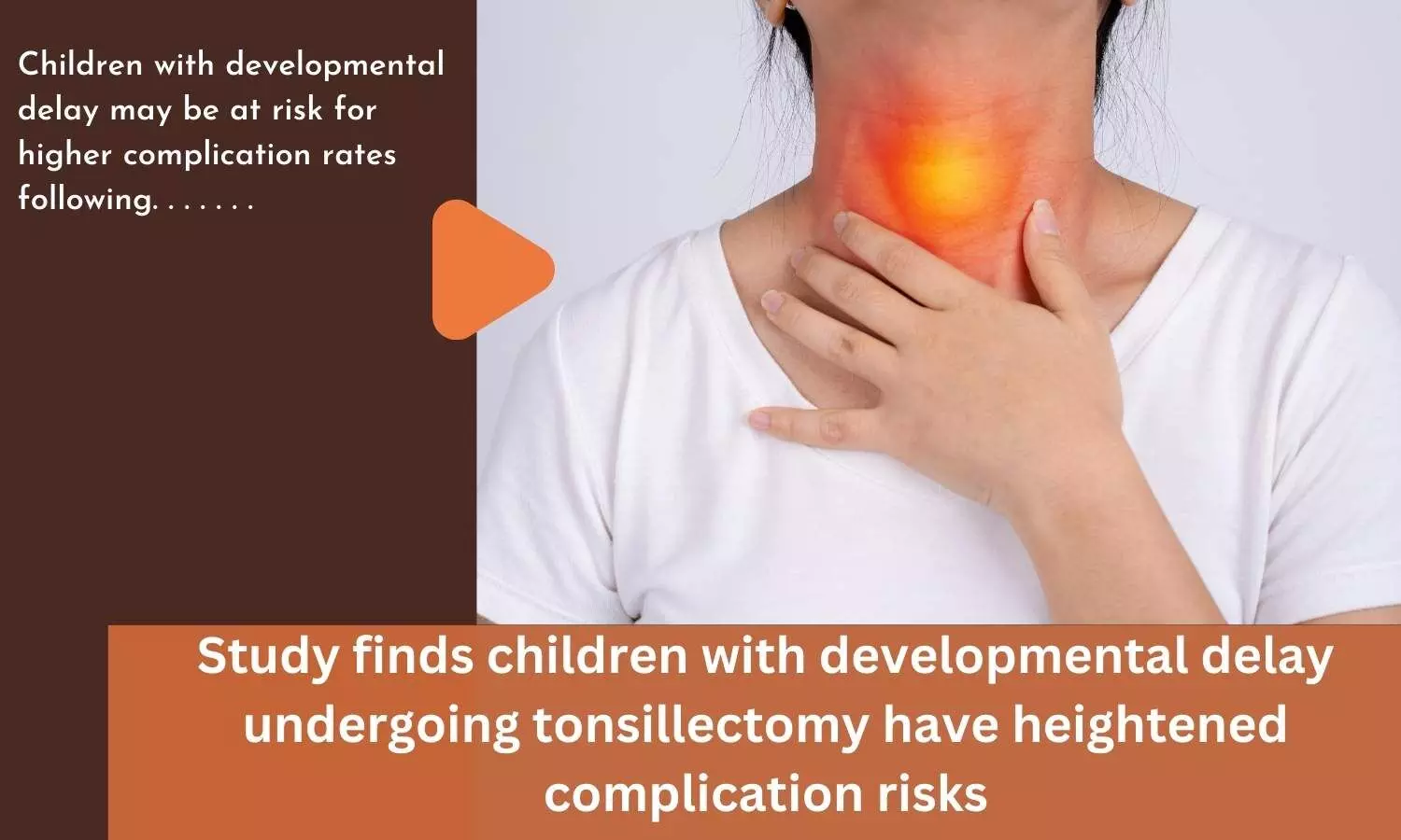 Study finds children with developmental delay undergoing tonsillectomy have heightened complication risks