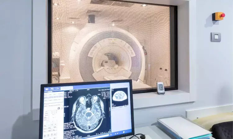 Novel MRI reveals brain changes in long-COVID patients