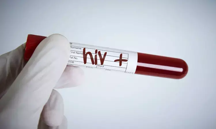 HIV positive cases on rise Haryana, claims Fortis Study