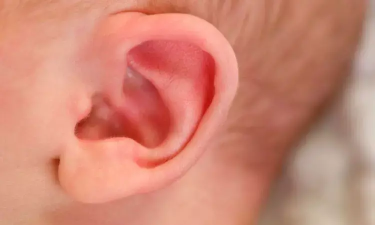 Non-surgical paper clip technique can treat certain infant ear deformities