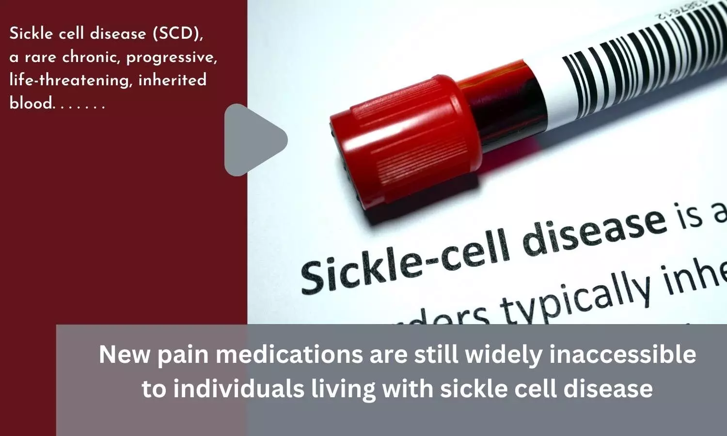 New pain medications are still widely inaccessible to individuals living with sickle cell disease