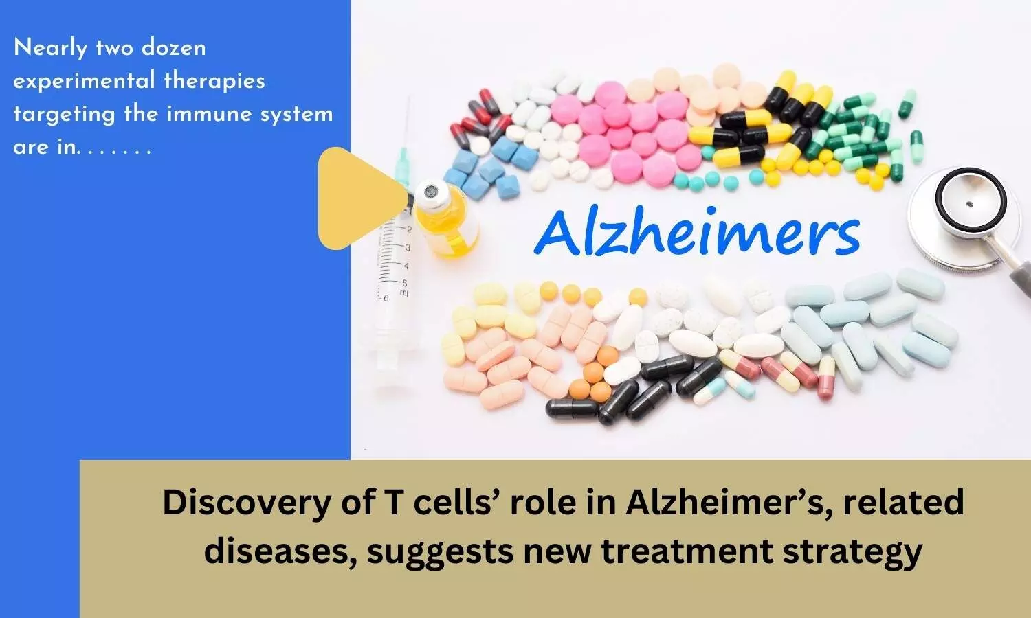 Discovery of T cells role in Alzheimers, related diseases, suggests new treatment strategy