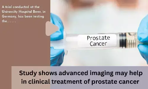 Study shows advanced imaging may help in clinical treatment of prostate cancer