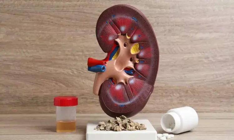 Metabolic syndrome may increase prevalence of kidney stones