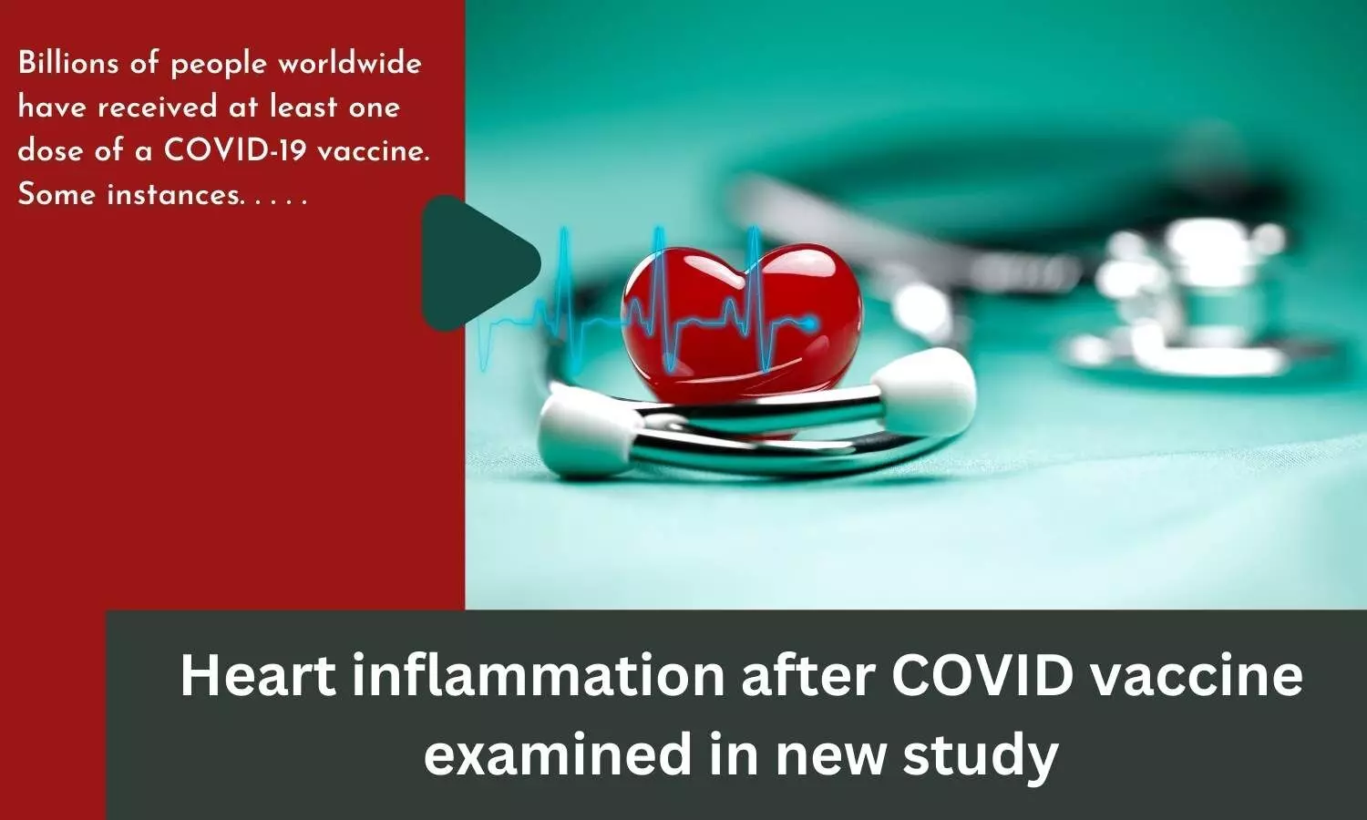 Heart inflammation after COVID vaccine examined in new study