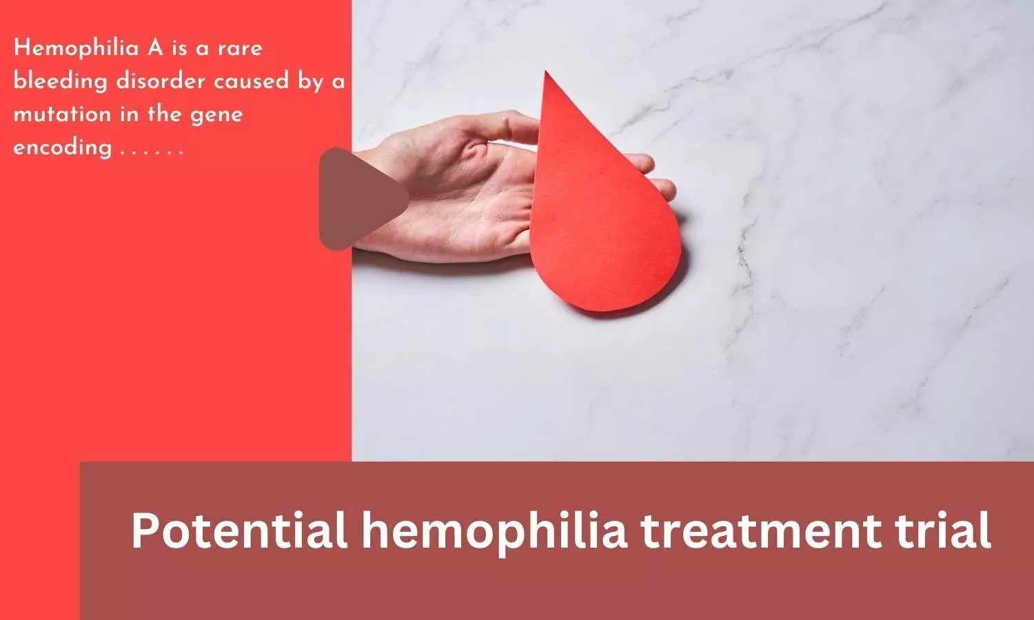 Potential hemophilia treatment trial