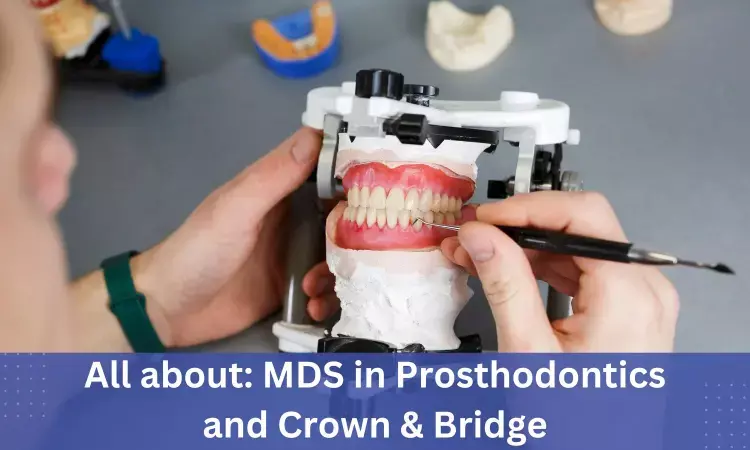 MDS Prosthodontics, Crown and Bridge: Admissions, Dental Colleges, Fees, Syllabus, Eligibility criteria details