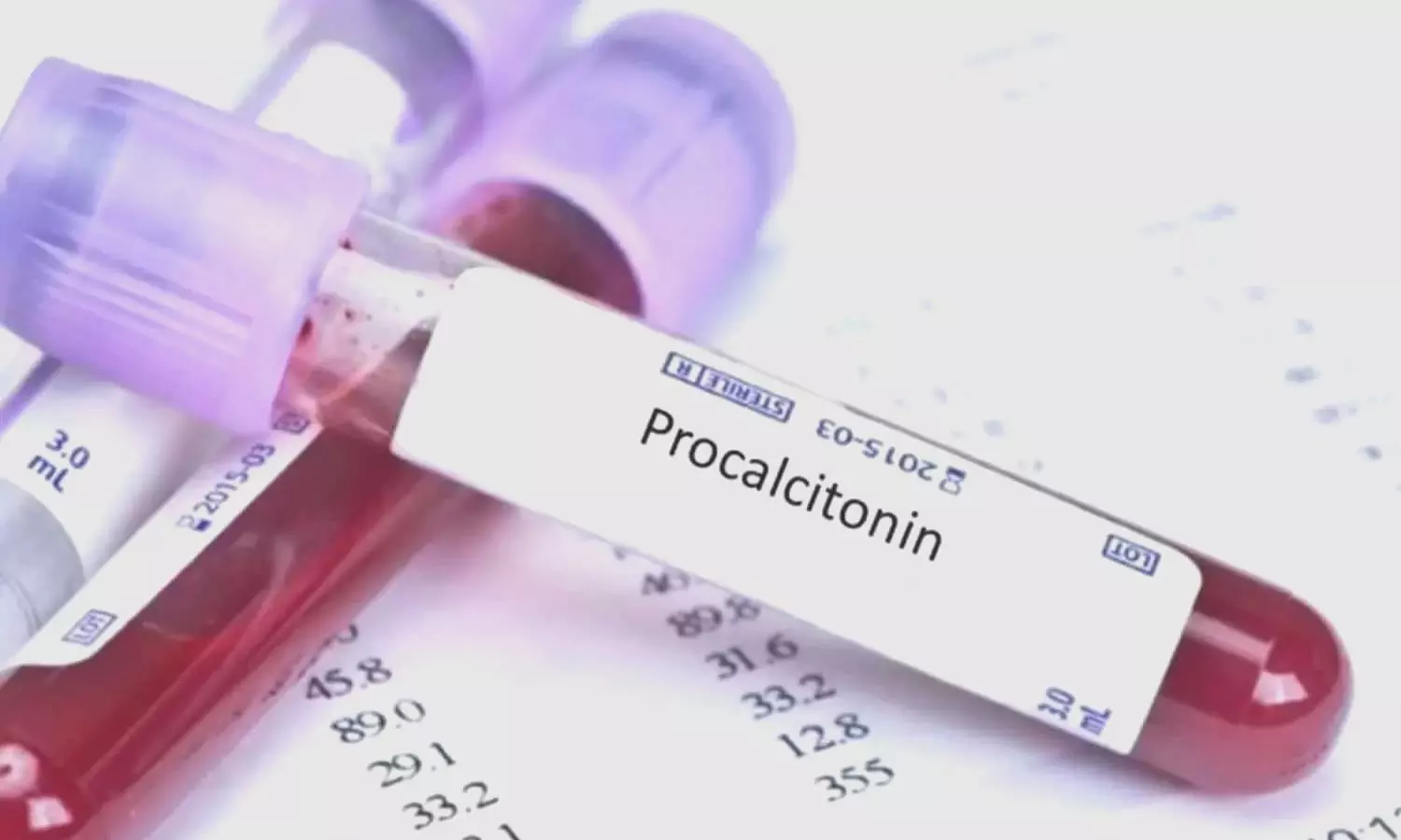 Use of procalcitonin for rational use of antibiotics: ISCCM Guidelines