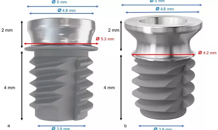 Short and Extrashort Dental Implants With Wide Diameter Appropriate for Implant-Supported Posterior Restorations