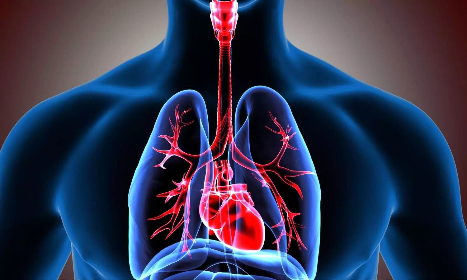 CHEST releases clinical practice guideline on respiratory management of patients with neuromuscular weakness