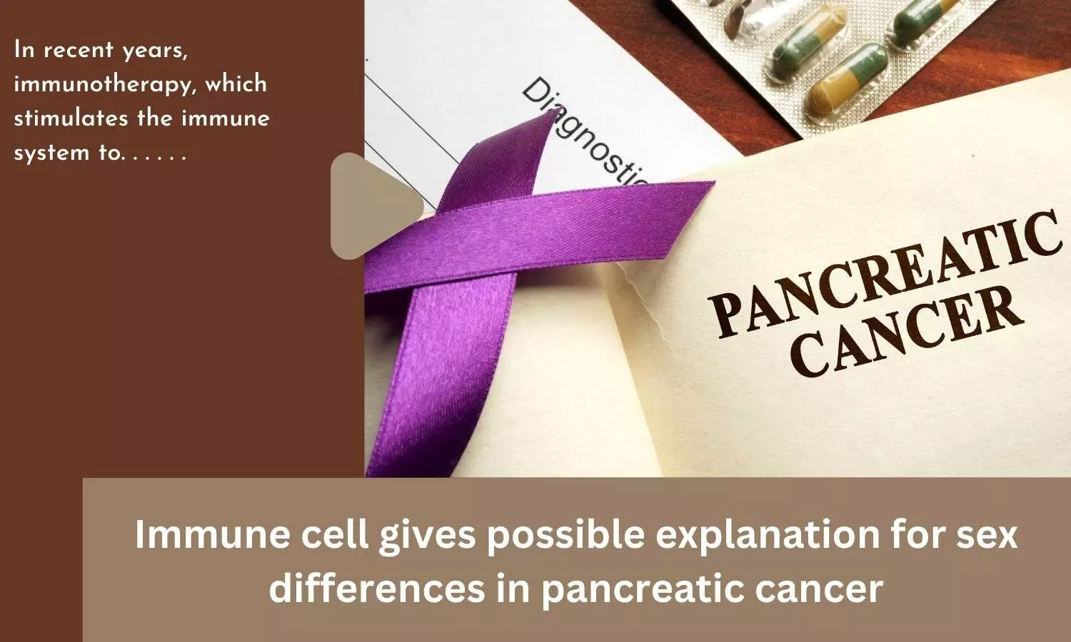 Immune cell gives possible explanation for sex differences in pancreatic cancer