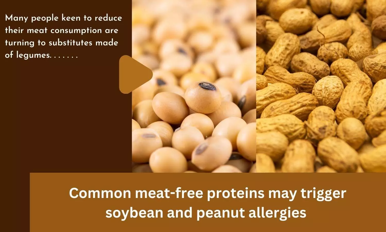 Common meat-free proteins may trigger soybean and peanut allergies