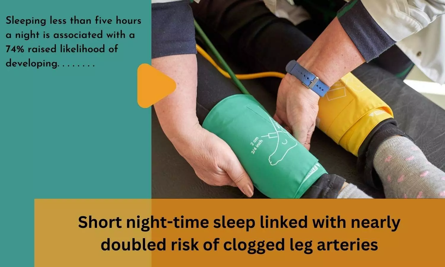 Short night-time sleep linked with nearly doubled risk of clogged leg arteries