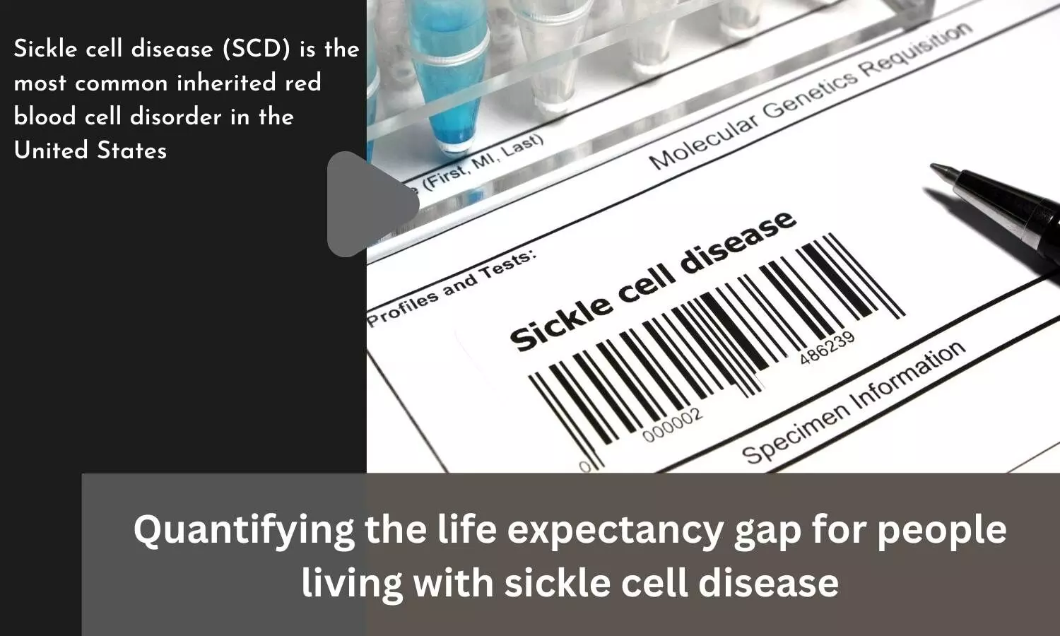 Quantifying the life expectancy gap for people living with sickle cell disease