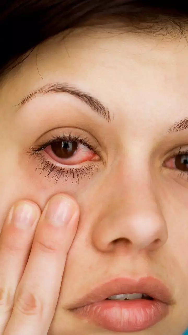 All You Need To Know About Glaucoma, This Glaucoma Week