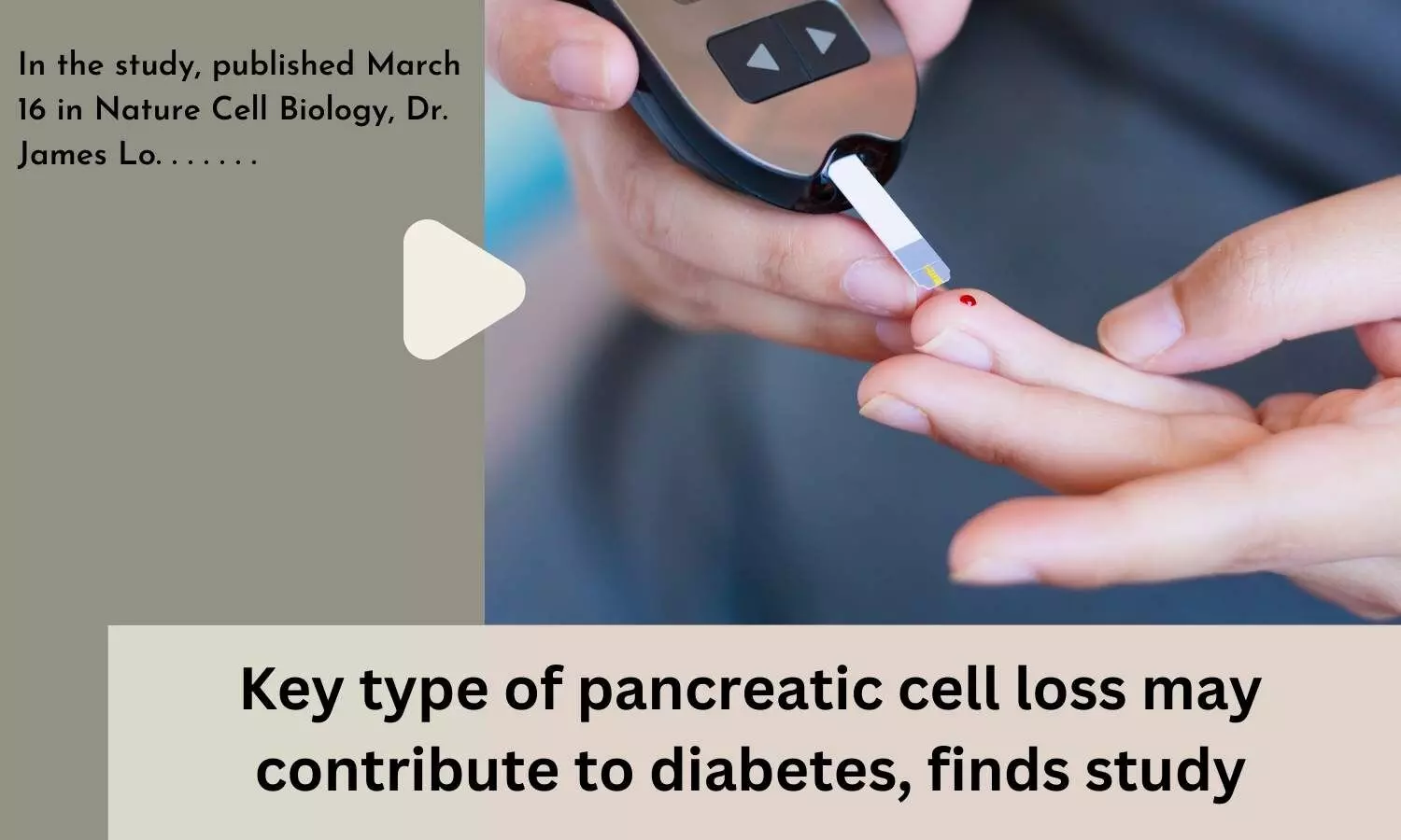 Key type of pancreatic cell loss may contribute to diabetes, finds study