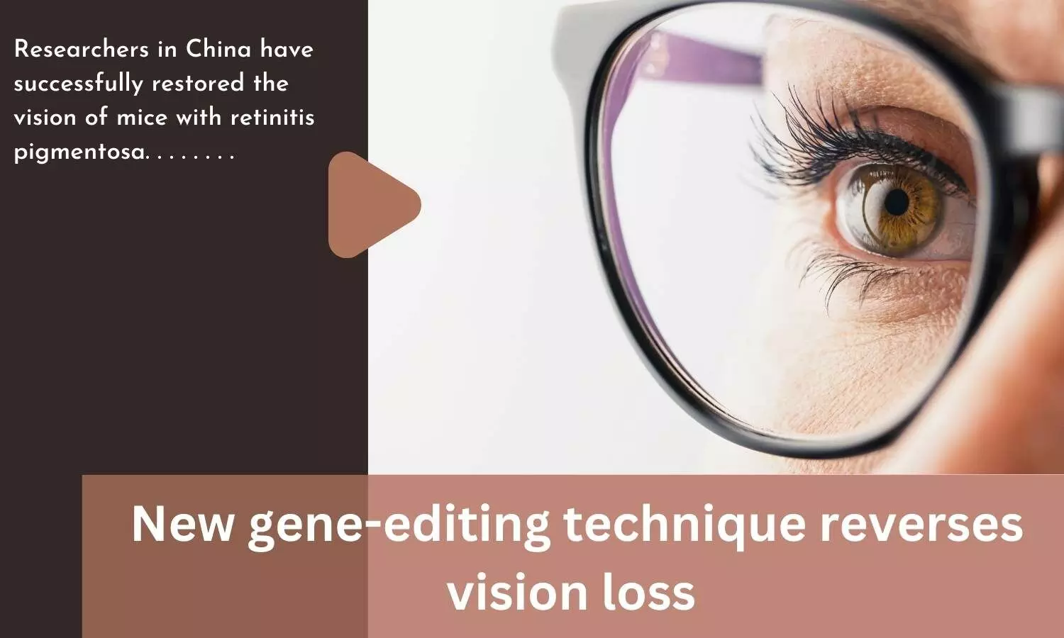 New gene-editing technique reverses vision loss