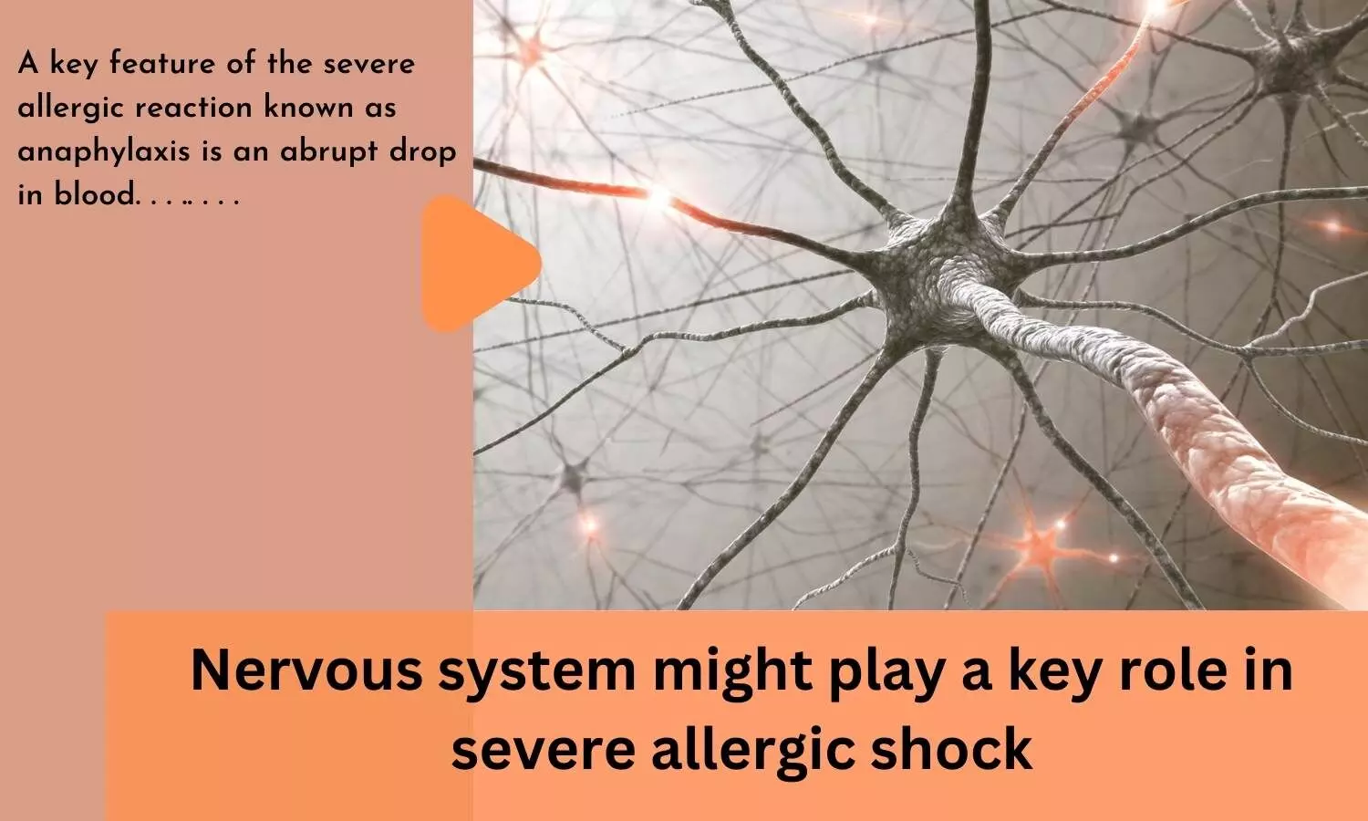 Nervous system might play a key role in severe allergic shock