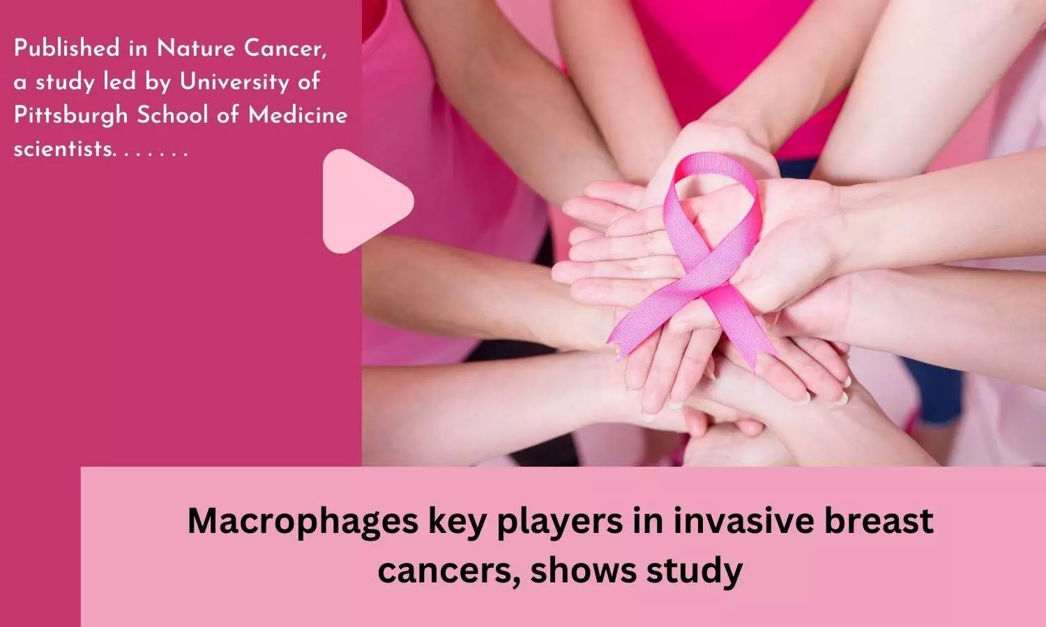 Macrophages key players in invasive breast cancers, shows study