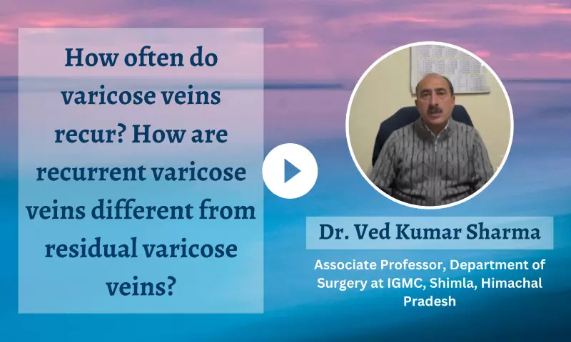 How often do varicose veins recur, and how are recurrent varicose veins different from residual varicose veins? - Dr Ved Kumar Sharma