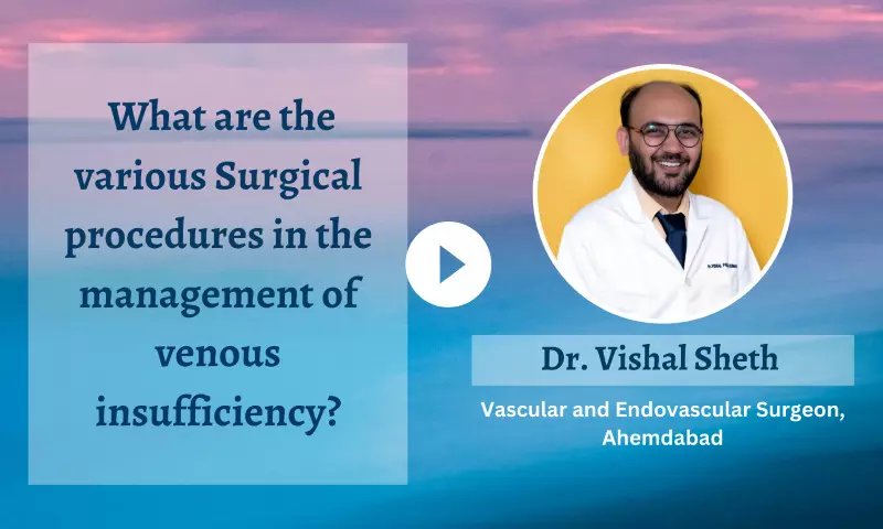 Surgical procedures in management of venous insufficiency - Dr Vishal Sheth