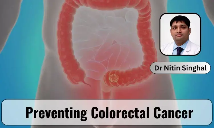 March Colorectal Cancer Awareness Month Special: Decoding Colorectal Cancer And Its Prevention - Dr Nitin Singhal