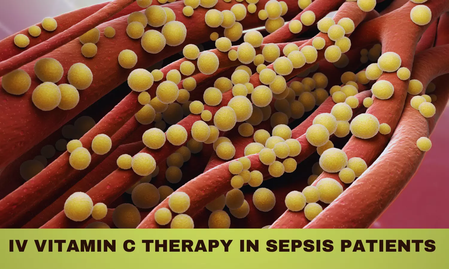 Does vitamin C therapy improve outcomes in sepsis patients? Study sheds light