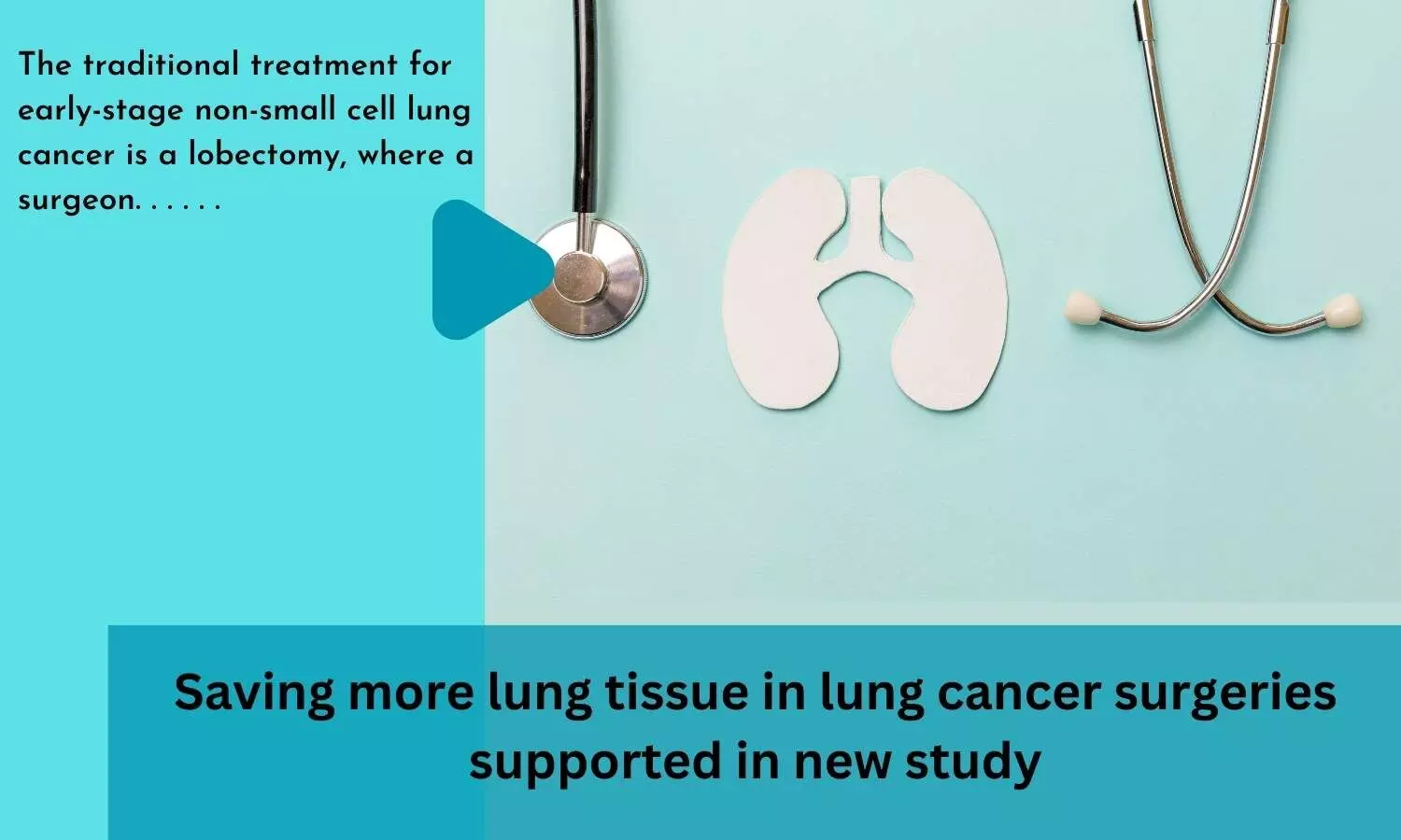 Saving more lung tissue in lung cancer surgeries supported in new study