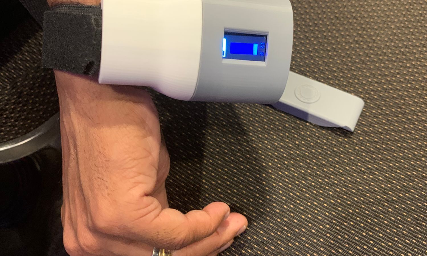 Wrist Worn Transdermal Sensor For Troponin Measurement Can Help Early