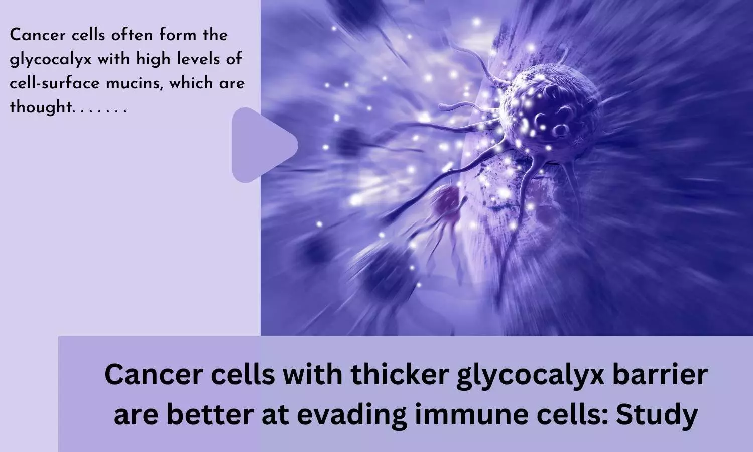 Cancer cells with thicker glycocalyx barrier are better at evading immune cells: Study