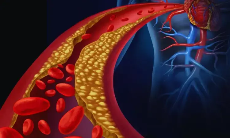 Streptococci bacteria in gut microbiome tied to coronary atherosclerosis: Circulation