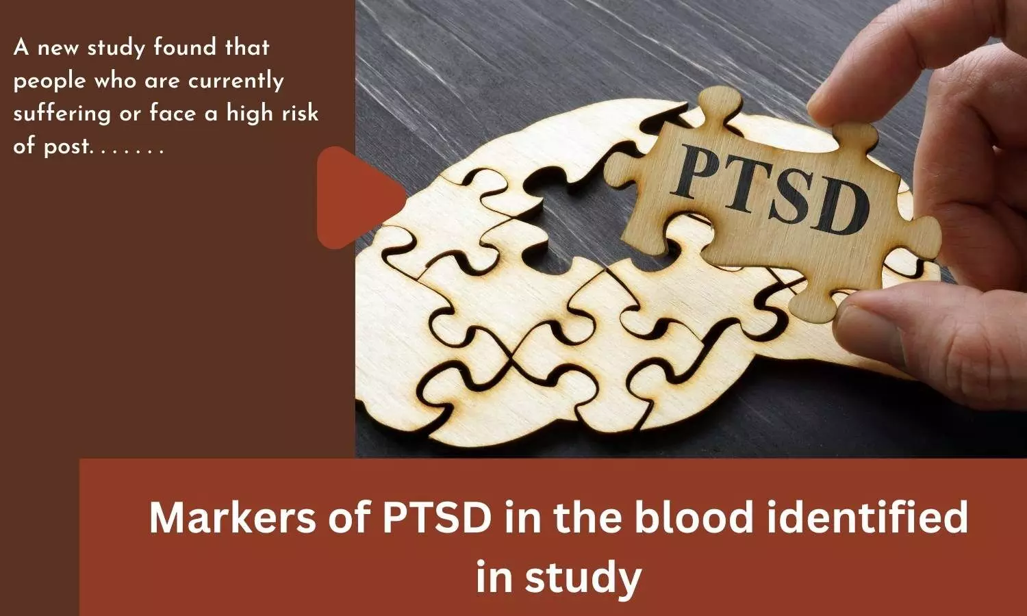 Markers of PTSD in the blood identified in study