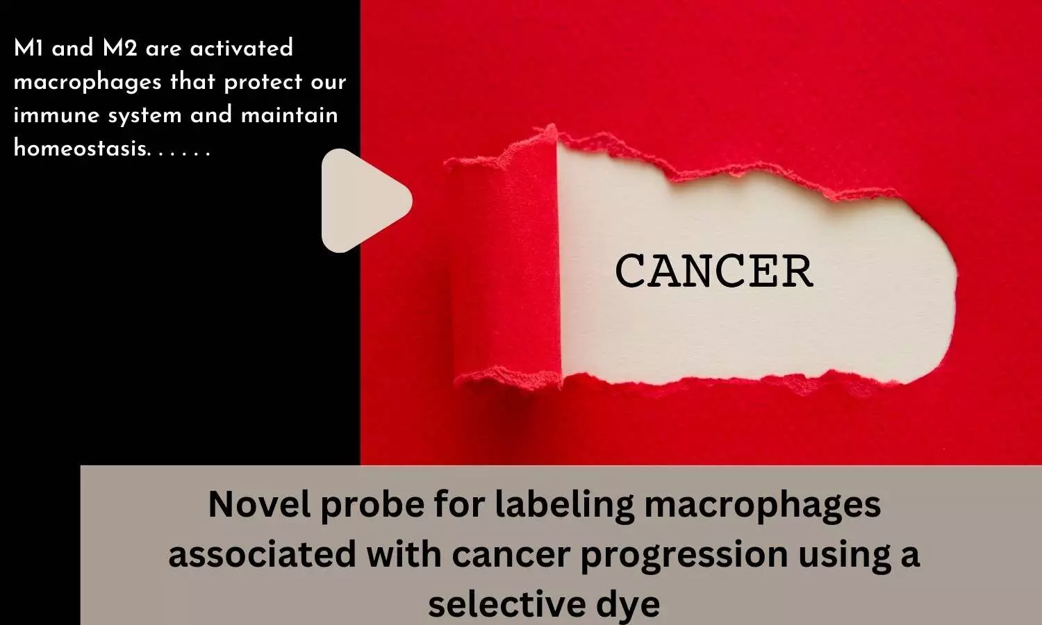 Novel probe for labeling macrophages associated with cancer progression using a selective dye