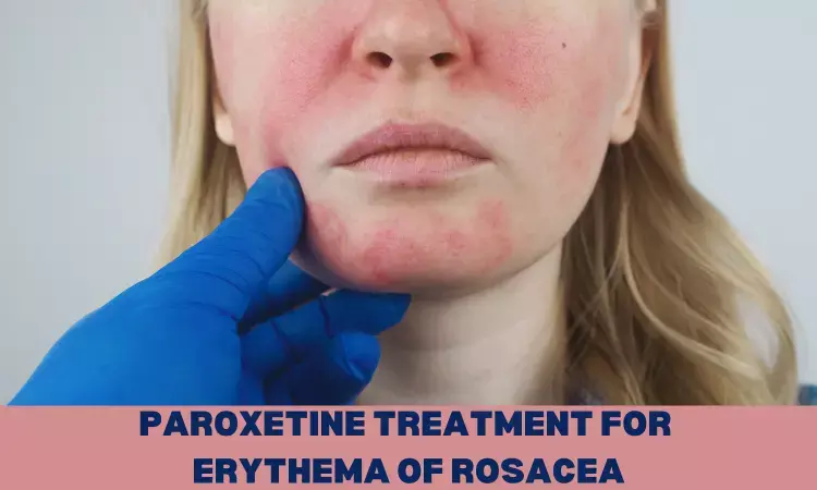 Paroxetine effective and well-tolerated treatment of erythema of rosacea