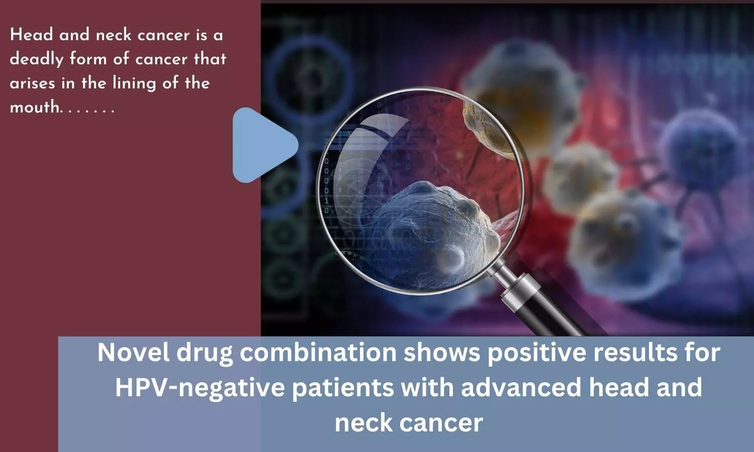 Novel drug combination shows positive results for HPV-negative patients with advanced head and neck cancer