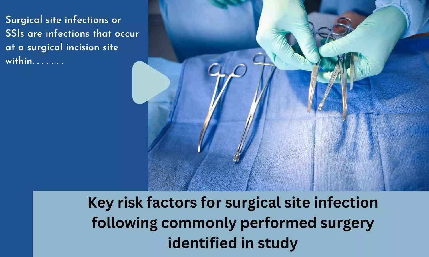 Key risk factors for surgical site infection following commonly performed surgery identified in study