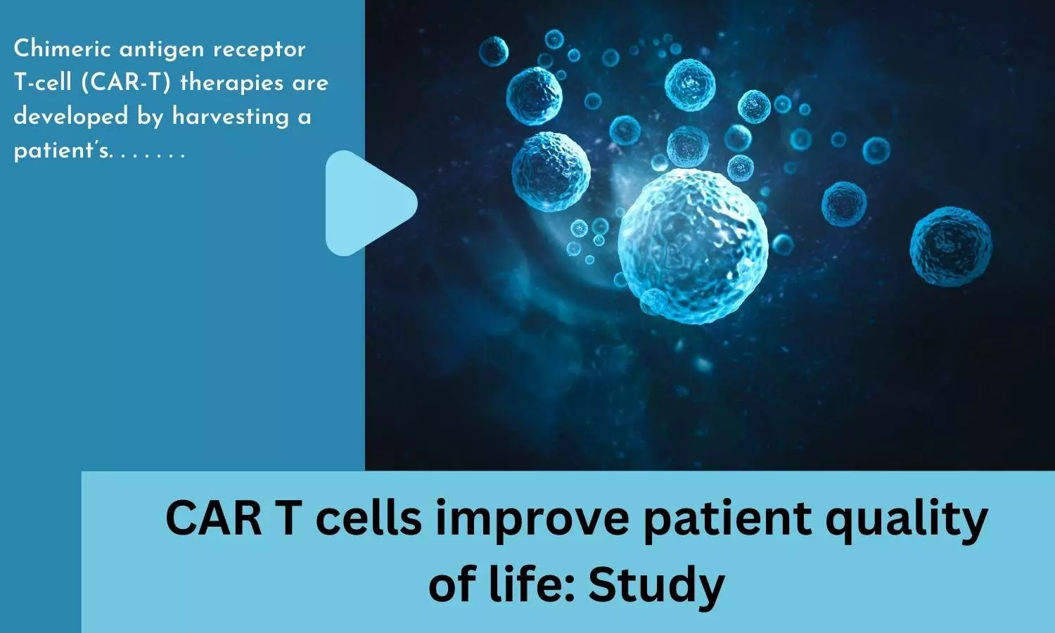 CAR T cells improve patient quality of life: Study