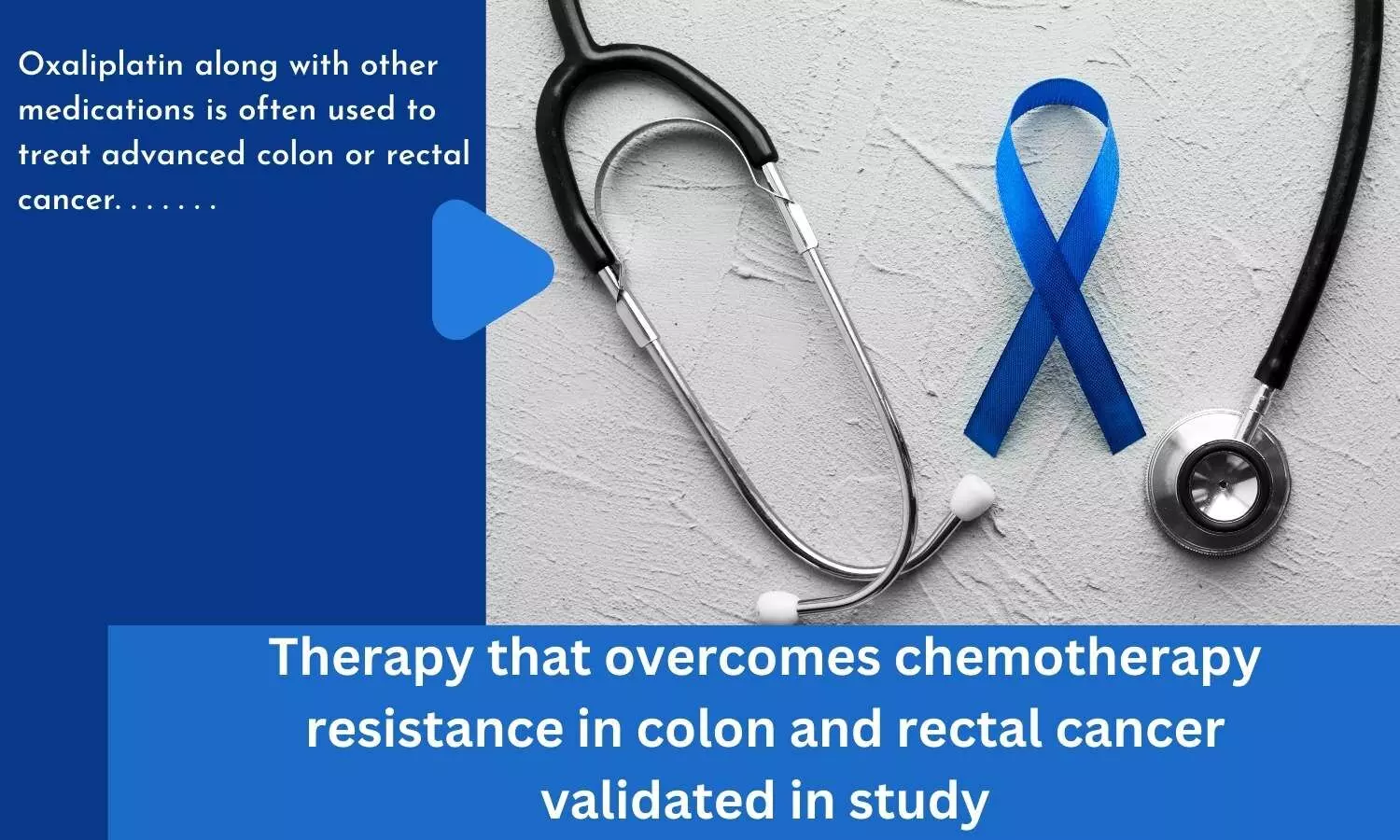Therapy that overcomes chemotherapy resistance in colon and rectal cancer validated in study