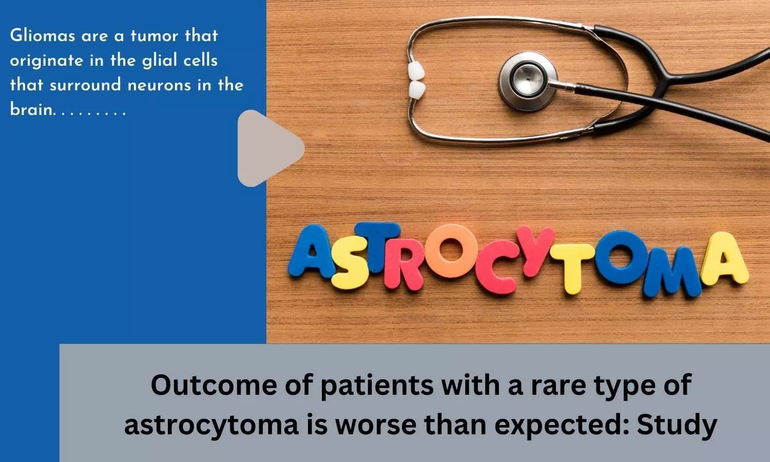 Outcome of patients with a rare type of astrocytoma is worse than expected: Study
