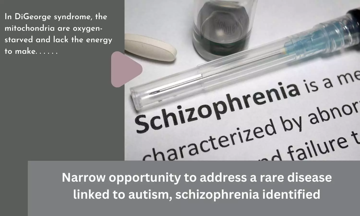 Narrow opportunity to address a rare disease linked to autism, schizophrenia identified