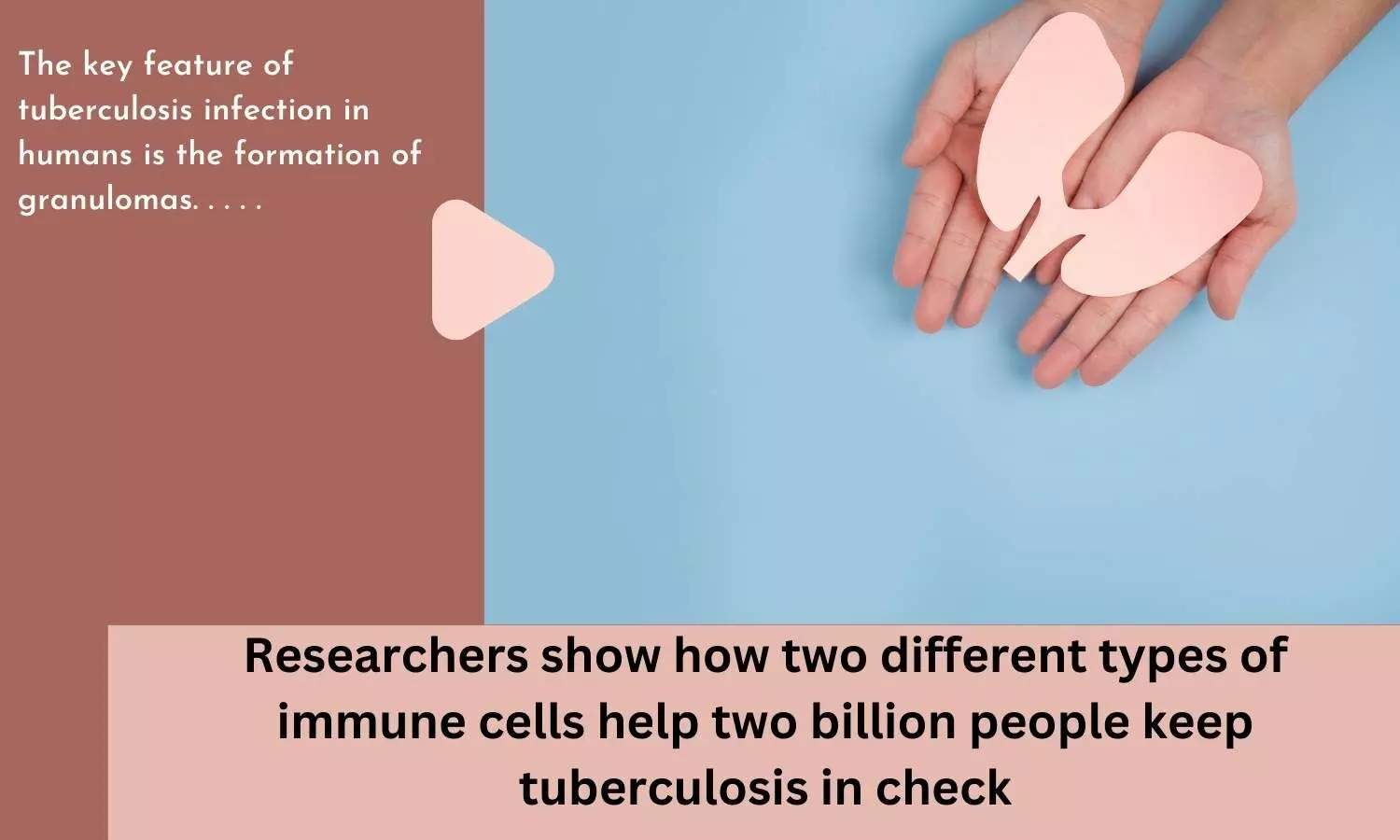Researchers show how two different types of immune cells help two billion people keep tuberculosis in check