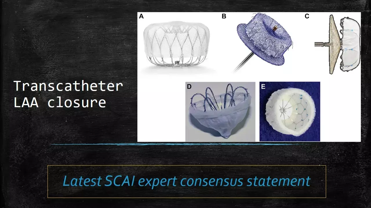 SCAI releases 2023-Expert consensus statement on transcatheter LAA closure