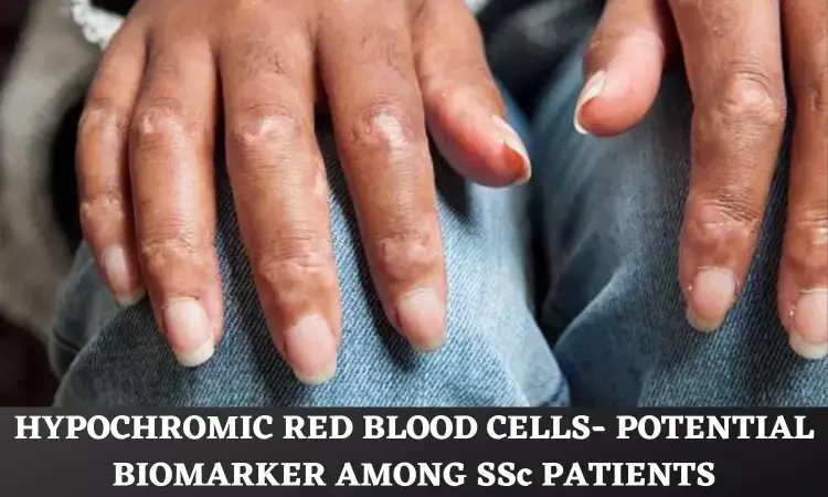 Hypochromic Red Cells Identified as Potential Biomarker for Mortality Risk Among Systemic Sclerosis Patients