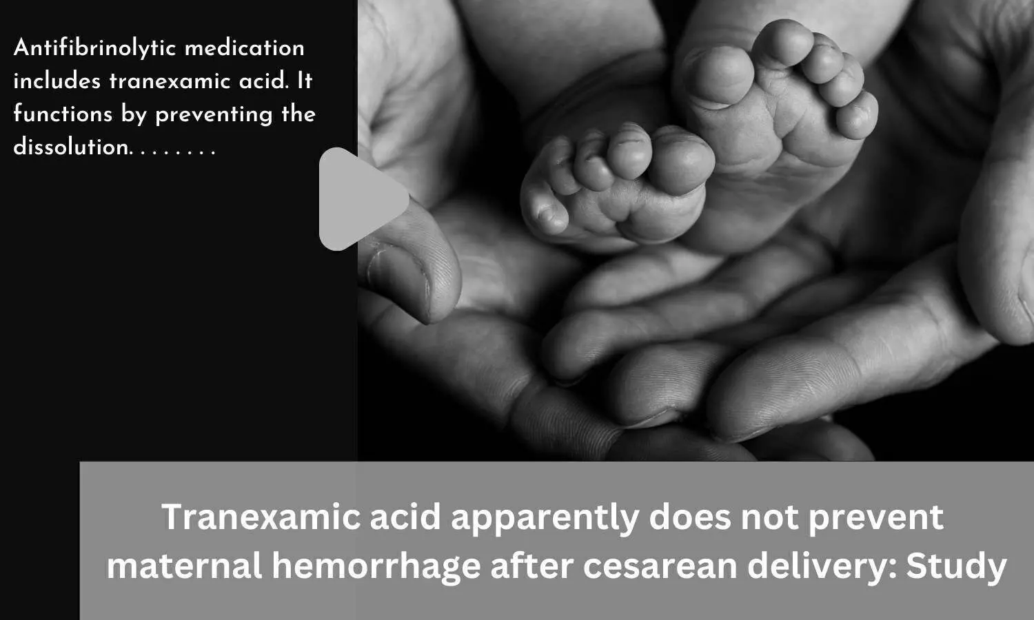 Tranexamic acid apparently does not prevent maternal hemorrhage after cesarean delivery: Study