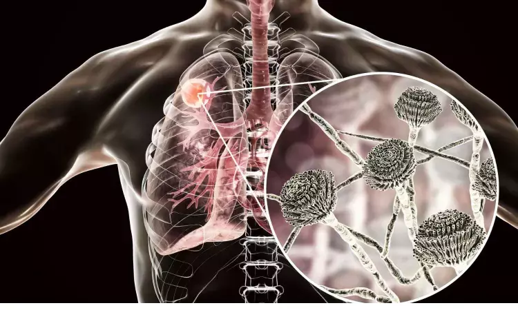 Type of Allergy medicine may have role in treatment of lung cancer