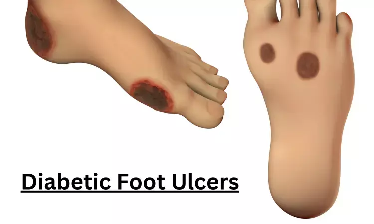 Defective closure of diabetic foot ulcers associated with higher risk of wound recurrence