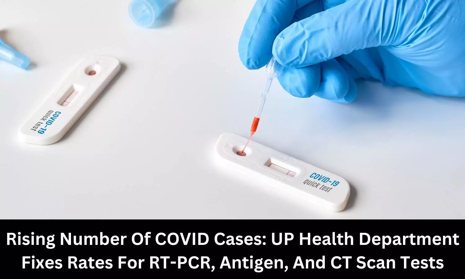 UP Health Department fixes rates of COVID tests at private pathology, diagnostic centres