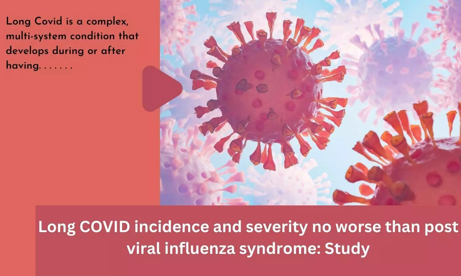 Long COVID incidence and severity no worse than post viral influenza syndrome: Study